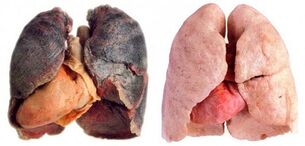 sigara içenlerin akciğerleri ve sağlıklı